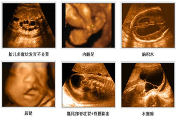 四维做了十几次没成功 哪些人容易四维不通过